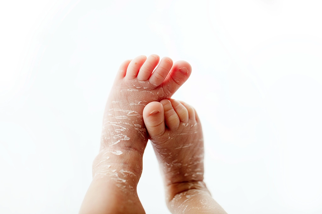 Tiny newborn baby feet photographed during a newborn photography session in Enfield, North London